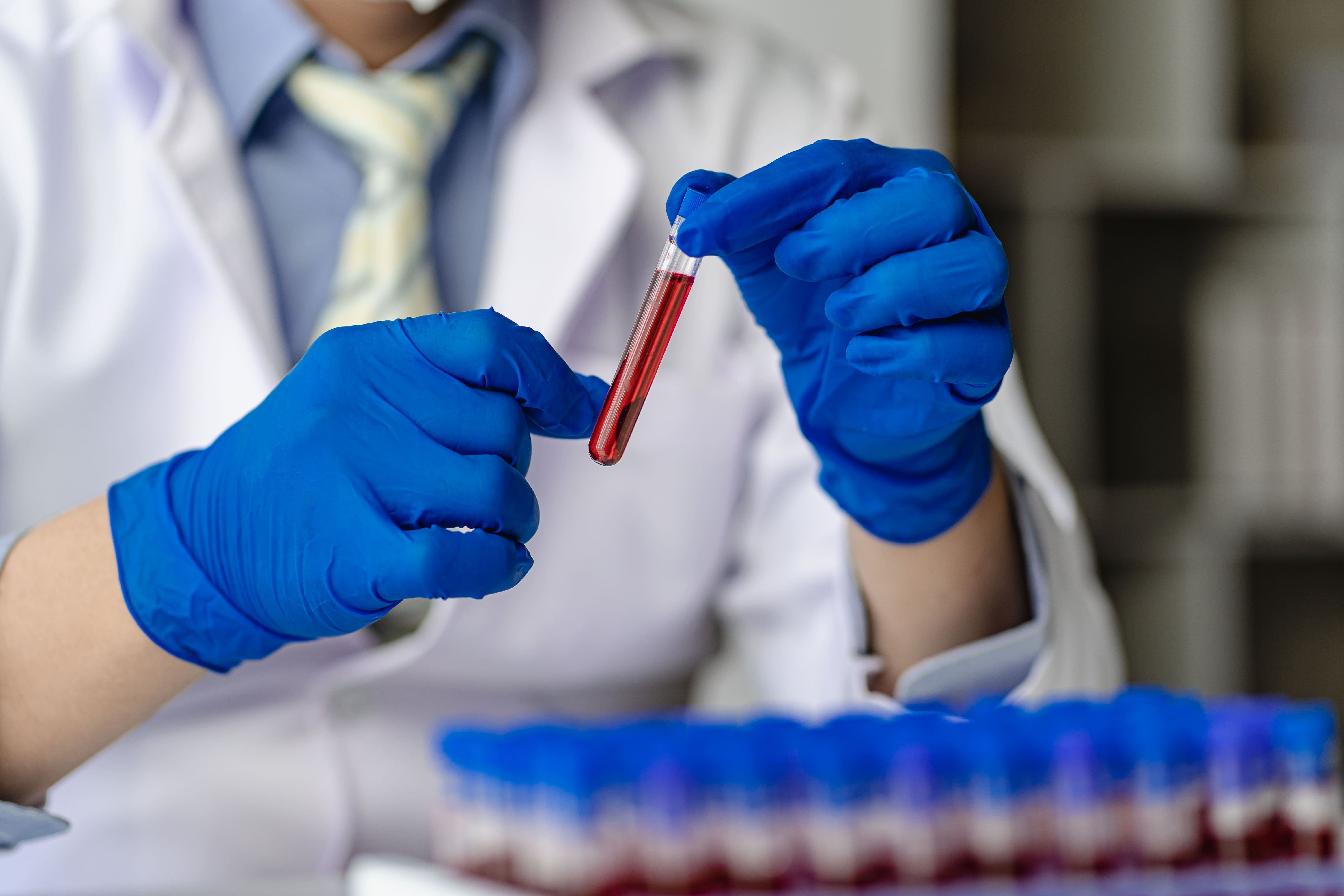 Que hace un hematologo