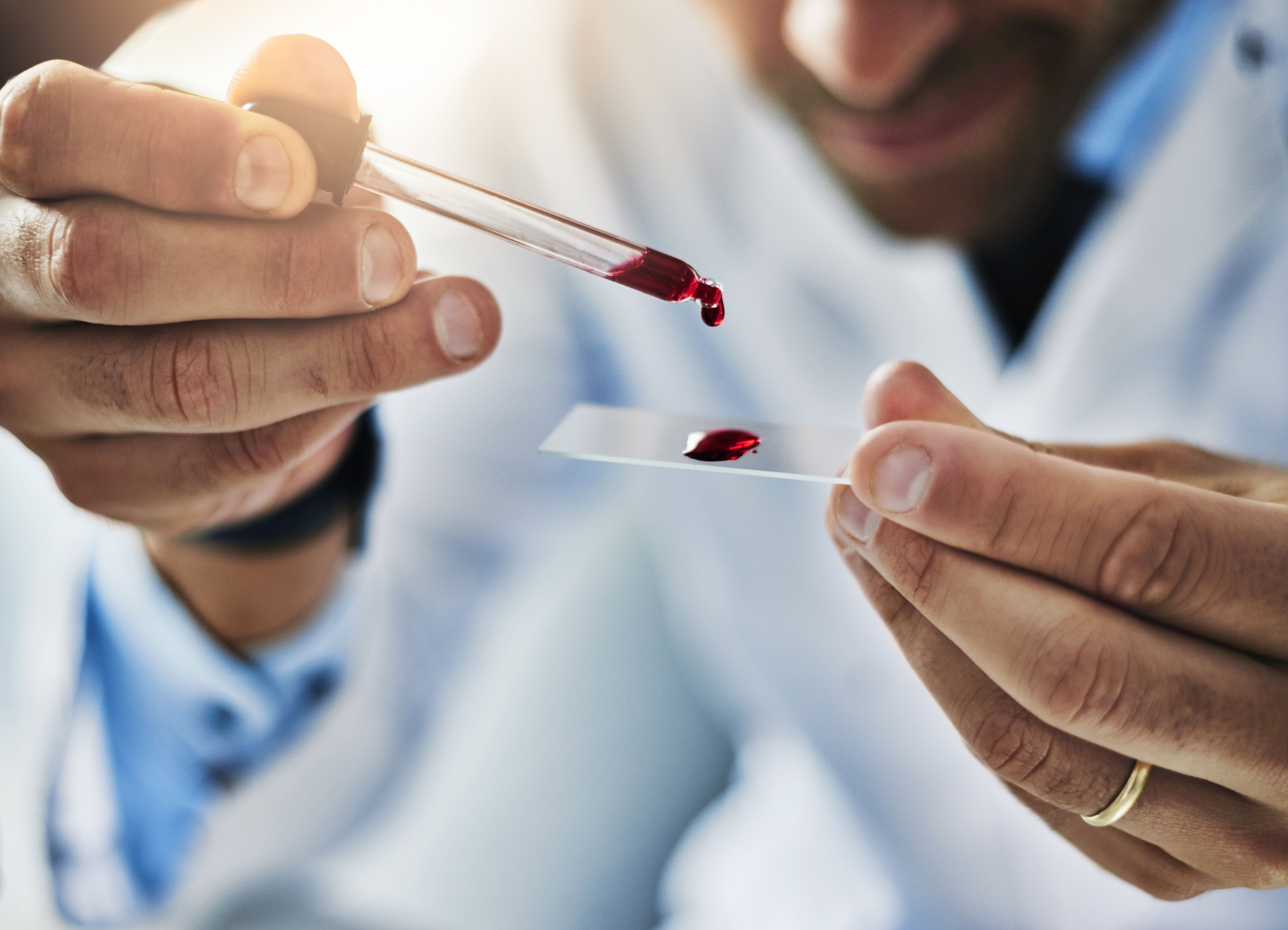 Que estudia la hematologia 